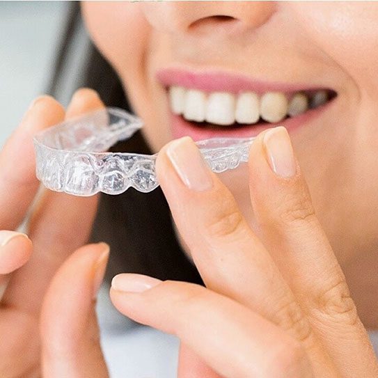 invisalign near me clear aligners